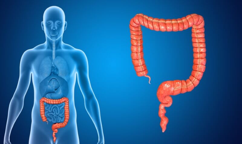 The Difference Between Colon Cancer and Hemorrhoids