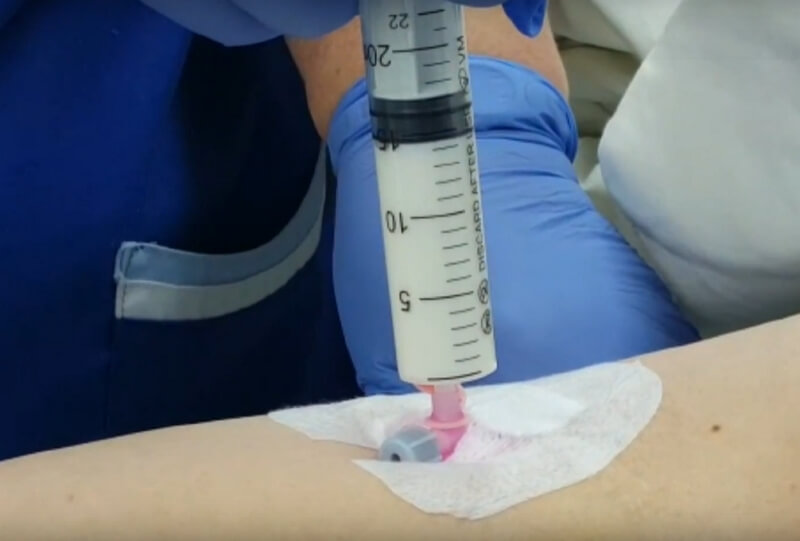 patient receiving sedative injection