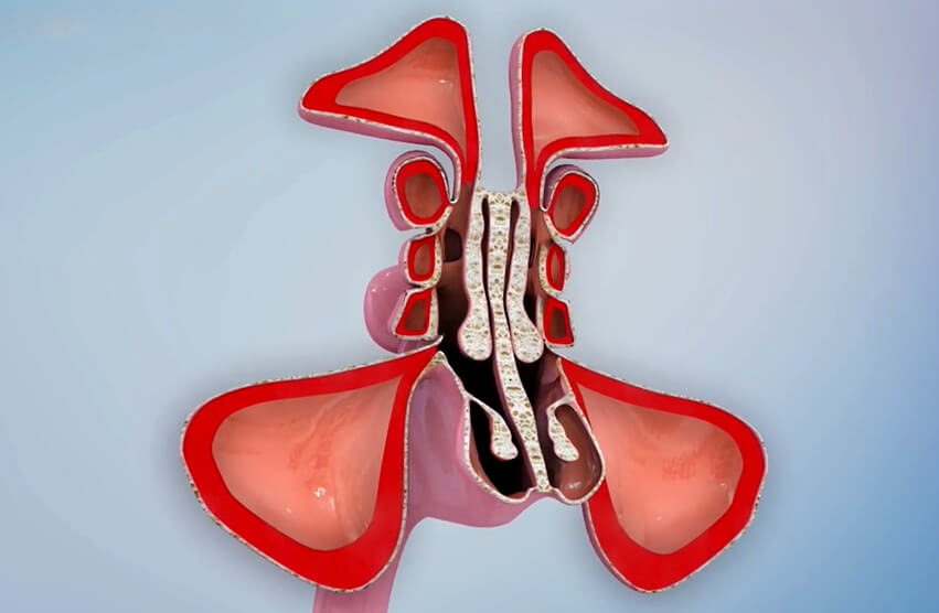 sinus infection illustration
